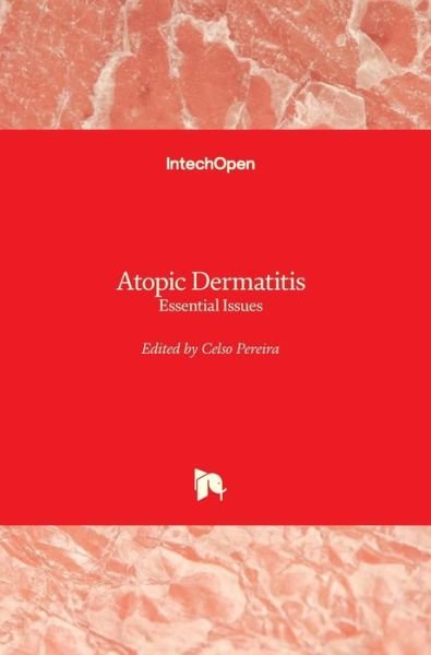 Cover for Celso Pereira · Atopic Dermatitis: Essential Issues (Hardcover bog) (2021)