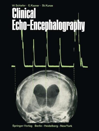 Wolfgang Schiefer · Clinical Echo-Encephalography (Pocketbok) [Softcover reprint of the original 1st ed. 1968 edition] (2012)
