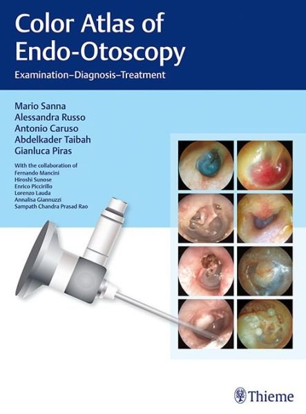 Cover for Mario Sanna · Color Atlas of Endo-Otoscopy: Examination - Diagnosis - Treatment (Hardcover Book) [1. Painos] (2017)