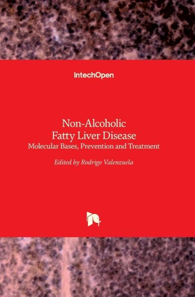 Cover for Rodrigo Valenzuela Baez · Non-Alcoholic Fatty Liver Disease: Molecular Bases, Prevention and Treatment (Hardcover bog) (2018)
