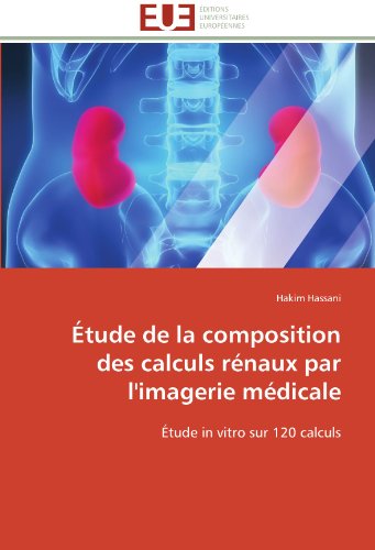 Cover for Hakim Hassani · Étude De La Composition Des Calculs Rénaux Par L'imagerie Médicale: Étude in Vitro Sur 120 Calculs (Paperback Book) [French edition] (2018)