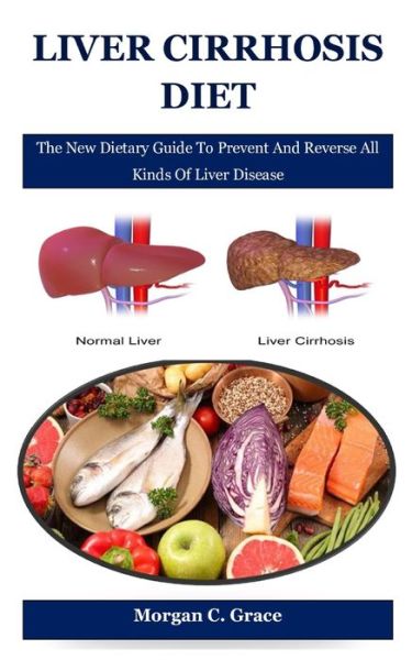 Cover for Morgan C Grace · Liver Cirrhosis Diet: The New Dietary Guide To Prevent And Reverse All Kinds Of Liver Disease (Paperback Book) (2021)