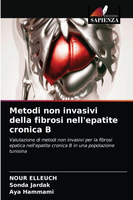 Cover for Nour Elleuch · Metodi non invasivi della fibrosi nell'epatite cronica B (Paperback Book) (2020)