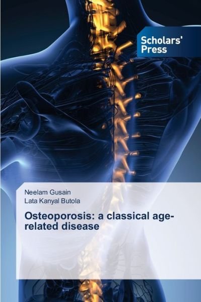 Cover for Gusain · Osteoporosis: a classical age-re (Book) (2020)