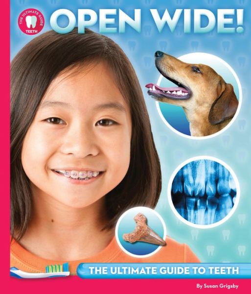 Cover for Susan Grigsby · Open Wide: The Ultimate Guide to Teeth - The Ultimate Guide to... (Hardcover Book) (2017)