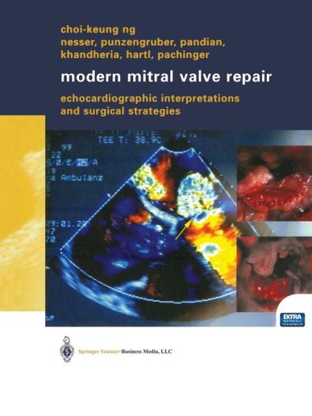 Cover for Choi-keung Ng · Modern Mitral Valve Repair: Echocardiographic Interpretations and Surgical Strategies (Paperback Book) [Softcover Reprint of the Original 1st Ed. 2003 edition] (2014)