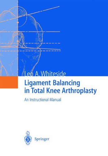 Cover for Leo A. Whiteside · Ligament Balancing in Total Knee Arthroplasty: An Instructional Manual (Pocketbok) [Softcover reprint of the original 1st ed. 2004 edition] (2011)