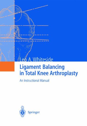 Ligament Balancing in Total Knee Arthroplasty: An Instructional Manual - Leo A. Whiteside - Bøger - Springer-Verlag Berlin and Heidelberg Gm - 9783642639241 - 15. september 2011