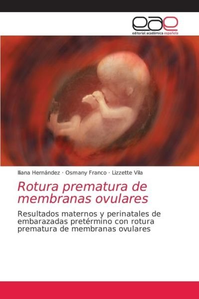 Cover for Iliana Hernández · Rotura prematura de membranas ovulares (Paperback Book) (2021)