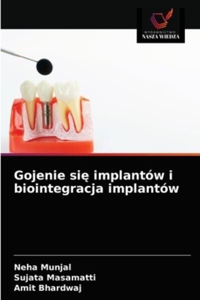 Cover for Neha Munjal · Gojenie si? implantow i biointegracja implantow (Paperback Book) (2021)