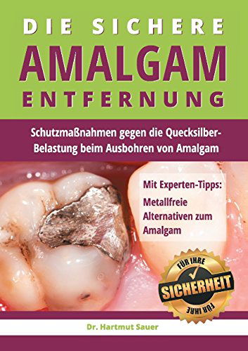 Cover for Dr Hartmut Sauer · Die Sichere Amalgam-entfernung (Paperback Book) [German edition] (2014)