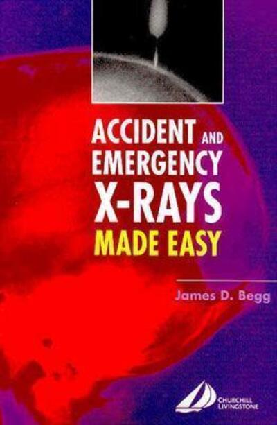 Cover for Begg · Accident and Emergency X-rays Made Easy, International Edition - Made Easy (Paperback Book) (2004)