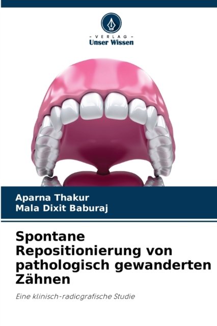 Cover for Aparna Thakur · Spontane Repositionierung von pathologisch gewanderten Zahnen (Paperback Bog) (2021)