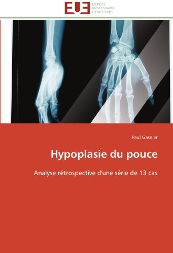 Cover for Paul Gasnier · Hypoplasie Du Pouce: Analyse Rétrospective D'une Série De 13 Cas (Paperback Book) [French edition] (2018)