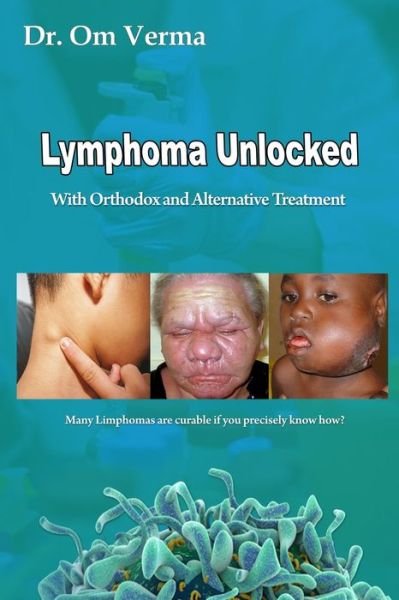 Lymphoma Unlocked: With Orthodox and Alternative Treatment - Cancer Library - Om Verma - Kirjat - Independently Published - 9798649589246 - perjantai 29. toukokuuta 2020