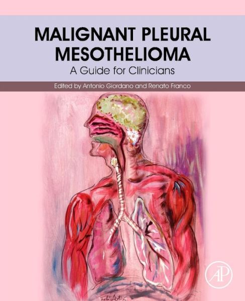 Cover for Antonio Giordano · Malignant Pleural Mesothelioma: A Guide for Clinicians (Paperback Book) (2019)