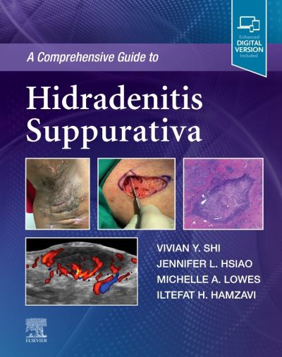 Cover for Shi, Vivian Y., MD (Associate Professor, Department of Dermatology, University of Arkansas for Medical Sciences, Little Rock, Arkansas, U.S.A.) · A Comprehensive Guide to Hidradenitis Suppurativa (Hardcover Book) (2022)