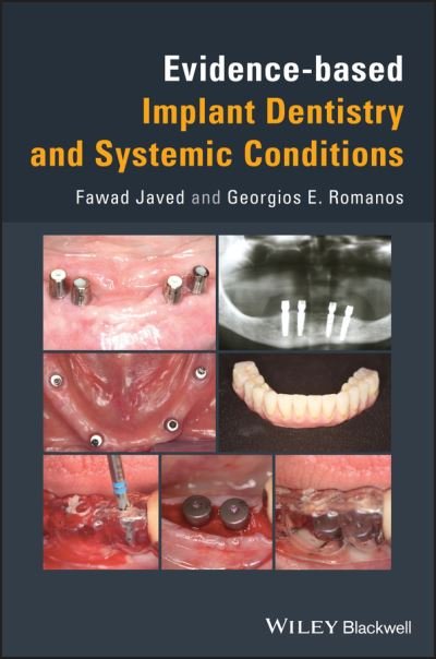 Cover for Fawad Javed · Evidence-based Implant Dentistry and Systemic Conditions (Gebundenes Buch) (2018)