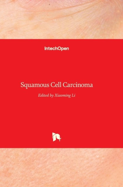 Cover for Xiaoming Li · Squamous Cell Carcinoma (Hardcover Book) (2012)