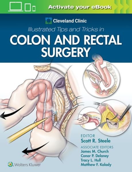 Cover for Scott Steele · Cleveland Clinic Illustrated Tips and Tricks in Colon and Rectal Surgery (Paperback Bog) (2020)