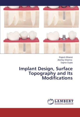 Cover for Sapna Gupta · Implant Design, Surface Topography and Its Modifications (Taschenbuch) (2014)