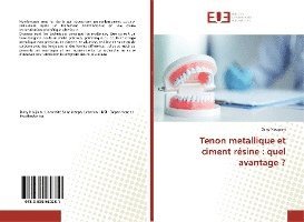 Cover for Dany Noujaim · Tenon metallique et ciment résine : quel avantage ? (Paperback Book) (2019)