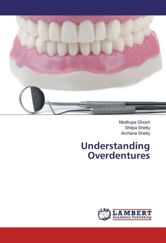 Cover for Ghosh · Understanding Overdentures (Book)