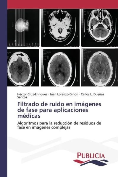 Cover for Duenas Santos Carlos L · Filtrado De Ruido en Imagenes De Fase Para Aplicaciones Medicas (Paperback Bog) (2015)