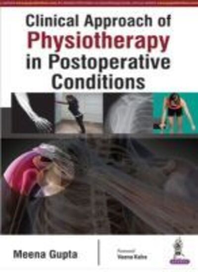 Cover for Gupta · Clinical Approach of Physiotherapy in Po (Paperback Book) (2016)