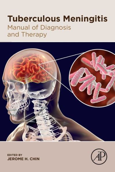 Cover for Jerome Chin · Tuberculous Meningitis: Manual of Diagnosis and Therapy (Paperback Book) (2020)