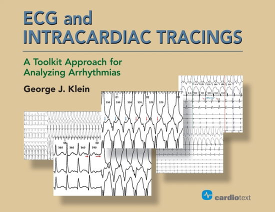 Cover for George J Klein · ECG and Intracardiac Tracings: A Toolkit Approach for Analyzing Arrhythmias (Paperback Book) (2018)