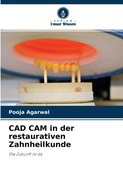 Cover for Pooja Agarwal · CAD CAM in der restaurativen Zahnheilkunde (Taschenbuch) (2021)
