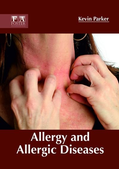 Cover for Kevin Parker · Allergy and Allergic Diseases (Inbunden Bok) (2018)