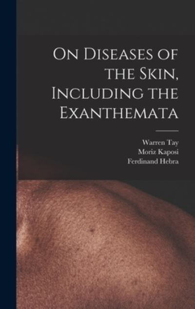 Cover for Moriz Kaposi · On Diseases of the Skin, Including the Exanthemata (Book) (2022)