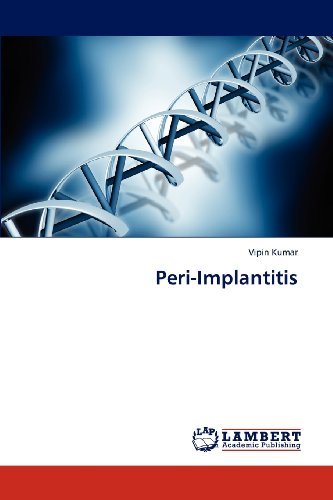 Cover for Vipin Kumar · Peri-implantitis (Paperback Book) (2013)