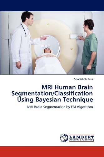 Cover for Soodabeh Safa · Mri Human Brain Segmentation / Classification Using Bayesian Technique: Mri Brain Segmentation by Em Algorithm (Pocketbok) (2012)