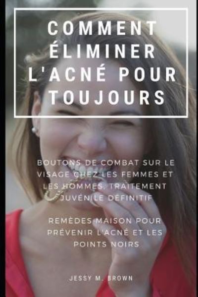 Cover for Jessy M Brown · Comment Eliminer l'Acne Pour Toujours (Paperback Book) (2019)