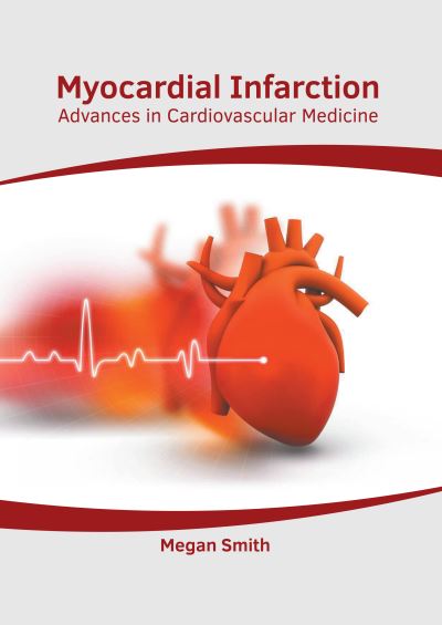 Cover for Megan Smith · Myocardial Infarction: Advances in Cardiovascular Medicine (Hardcover Book) (2020)