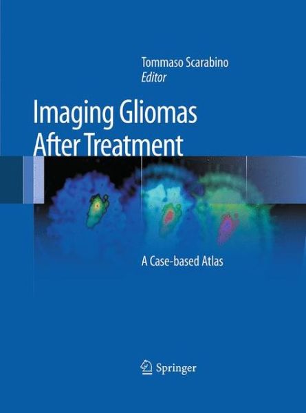 Cover for Imaging Gliomas After Treatment: A Case-based Atlas (Paperback Book) [Softcover reprint of the original 1st ed. 2012 edition] (2016)
