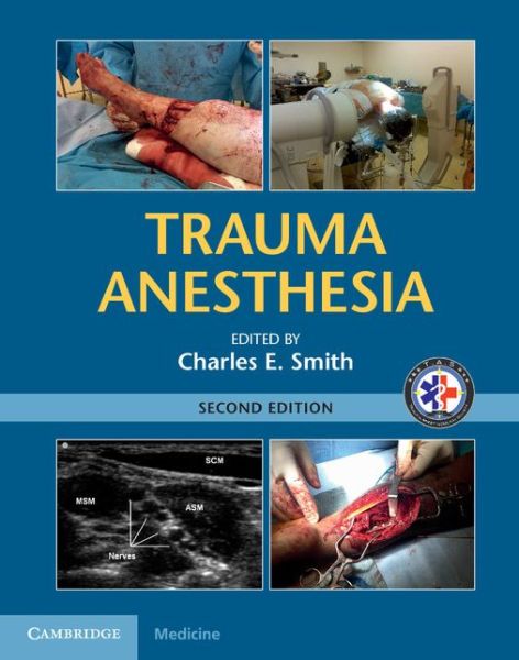 Cover for Charles Smith · Trauma Anesthesia (Hardcover Book) [2 Revised edition] (2015)