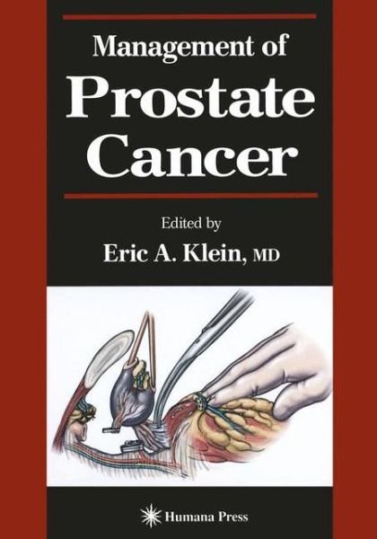 Cover for Eric a Klein · Management of Prostate Cancer - Current Clinical Urology (Pocketbok) [Softcover reprint of the original 1st ed. 2000 edition] (2012)