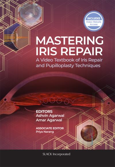 Cover for Ashvin Agarwal · Mastering Iris Repair: A Video Textbook of Iris Repair and Pupilloplasty Techniques (Paperback Book) (2020)