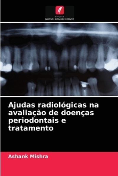 Cover for Ashank Mishra · Ajudas radiologicas na avaliacao de doencas periodontais e tratamento (Paperback Book) (2021)