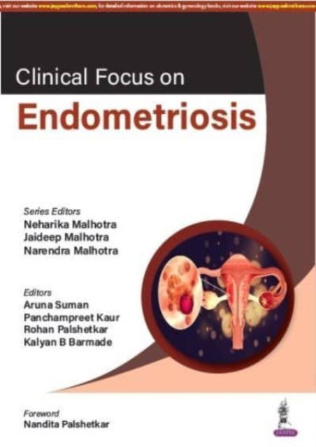 Cover for Neharika Malhotra · Clinical Focus on Endometriosis (Paperback Book) (2023)