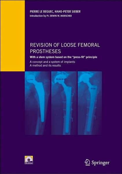 Cover for Pierre Le Beguec · Revision of loose femoral prostheses with a stem system based on the &quot;press-fit&quot; principle: A concept and its system of implants, a method and its results (Bok) [2007 edition] (2007)