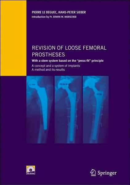 Cover for Pierre Le Beguec · Revision of loose femoral prostheses with a stem system based on the &quot;press-fit&quot; principle: A concept and its system of implants, a method and its results (Book) [2007 edition] (2007)