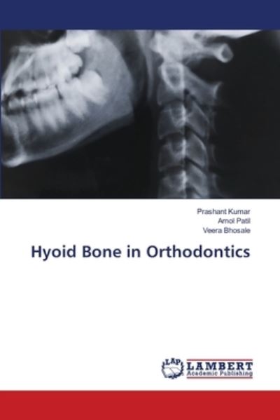 Cover for Prashant Kumar · Hyoid Bone in Orthodontics (Pocketbok) (2021)