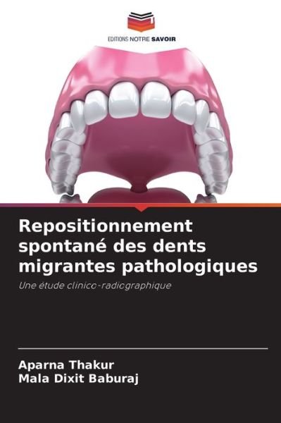 Cover for Aparna Thakur · Repositionnement spontane des dents migrantes pathologiques (Paperback Bog) (2021)