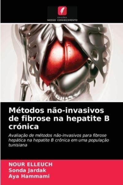 Cover for Nour Elleuch · Metodos nao-invasivos de fibrose na hepatite B cronica (Pocketbok) (2020)
