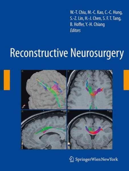 Cover for Wen-ta Chiu · Reconstructive Neurosurgery - Acta Neurochirurgica Supplement (Paperback Book) [Softcover reprint of hardcover 1st ed. 2008 edition] (2010)